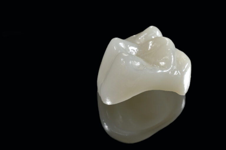 Ceramic Crowns Your Caring Sunshine Coast Dentist Hinterland View